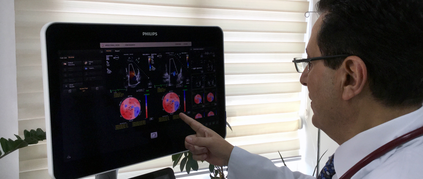 nabil tumači ultrazvuk srca